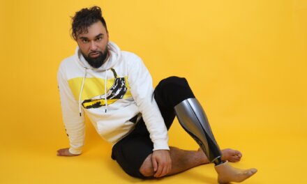 Ahány protézis, annyi vádli – Nincs különbség, bátorít a #unyqer